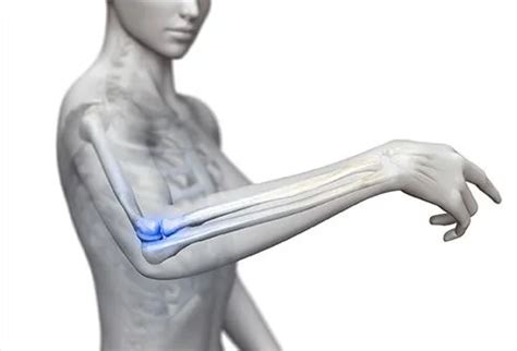 Dislocated Elbow Recovery, Symptoms, Treatment & Types - Okkii.com