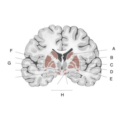 Neuro Week Flashcards Quizlet