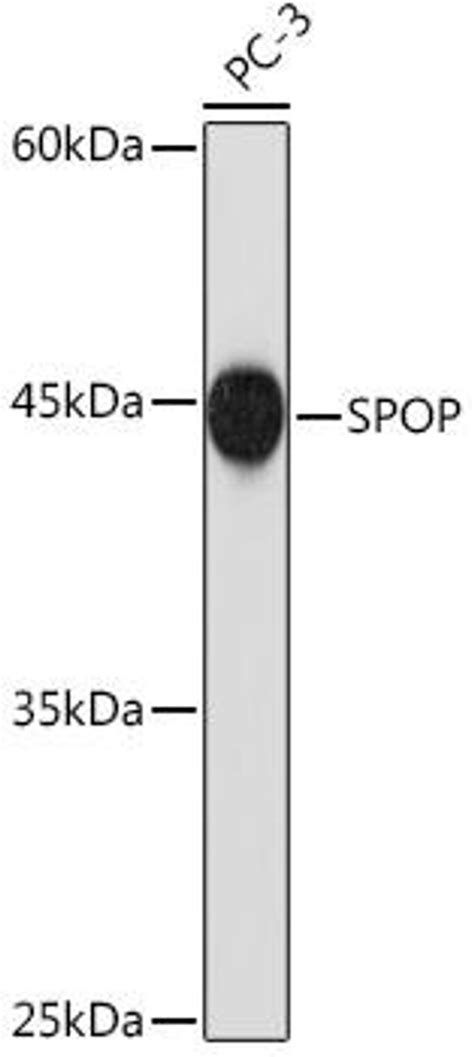 Anti Spop 抗体 Assay Genie