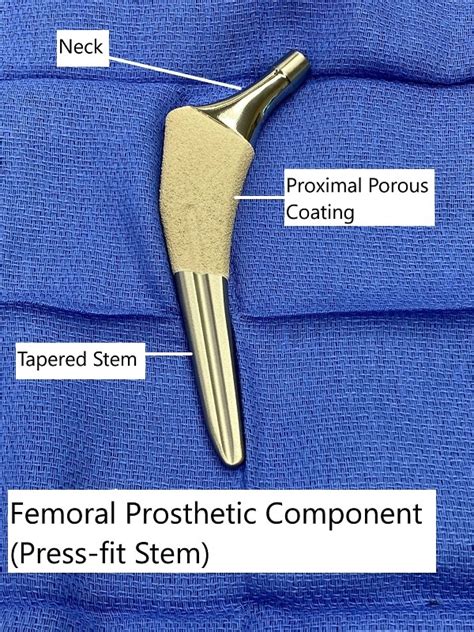 Total Hip Replacement - Complete Orthopedics | Multiple NY Locations