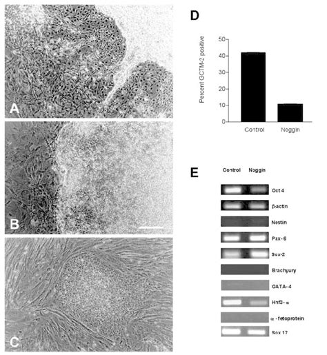 Effects Of Noggin On Human Es Cells A Area Of Differentiation In Es Download Scientific