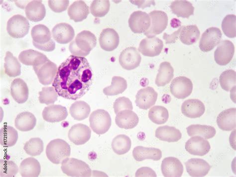 Neutrophils Under Microscope