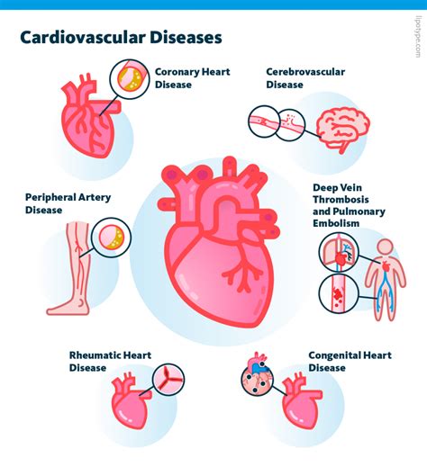 Lipidomics Of Cardiovascular Diseases Lipotype Gmbh