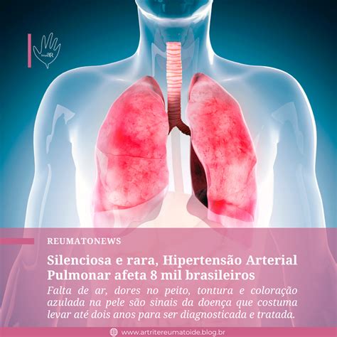 Silenciosa e rara Hipertensão Arterial Pulmonar afeta 8 mil