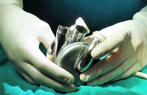 Bivacor Looks To Implant Its Artificial Heart In A Person Next Year