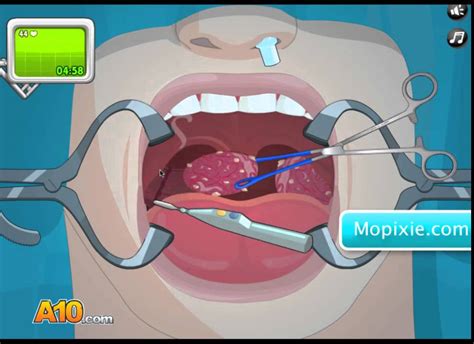 OPERATE NOW TONSIL SURGERY Play Tonsil Surgery Games Online YouTube