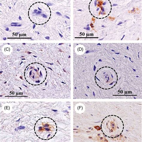 Colonyforming Aggregated Cells In The Maculae Flavae Of The Human