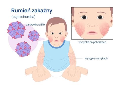 Rumie Zaka Ny U Dzieci Alab Laboratoria