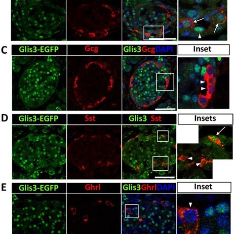 Glis3 Protein Is Selectively Expressed In Mouse Pancreatic Islets And