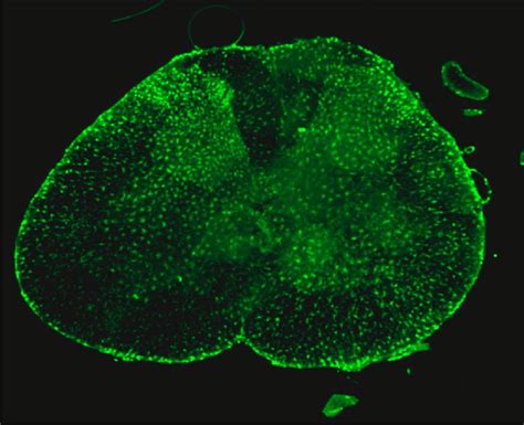 Iba Immunoreactivity Green In The L Spinal Cord Segment Of A Rat