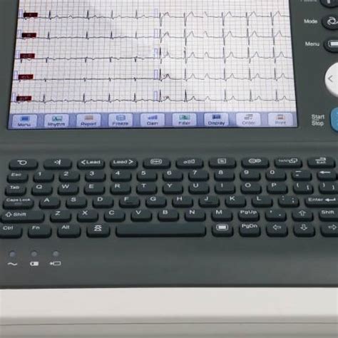 Touchscreen Interpretive 12 Lead EKG Machine For Rapid ECG Diagnosis