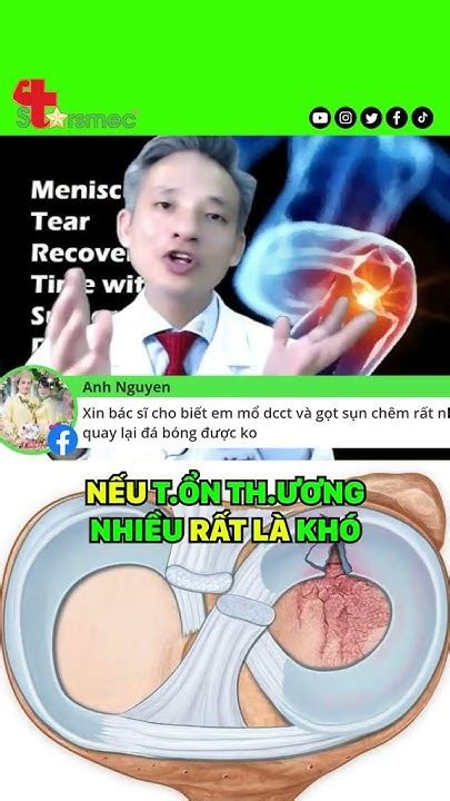 Tổn Thương Sụn Chêm Điều Trị Ngay Trước Khi Quá Muộn Y Học Thể Thao Starsmec Youtube