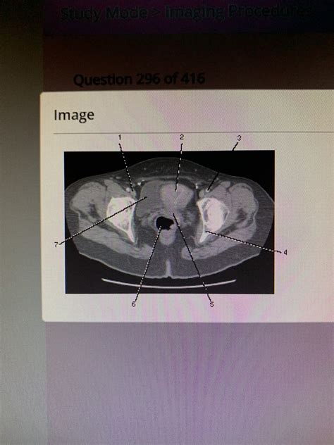 Ct Axial Pelvis Diagram Quizlet