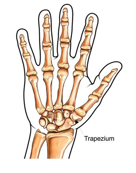 Osteoarthritis Treatment Trapeziectomy The Holly Private Hospital