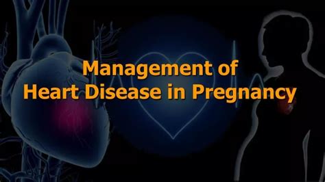 Ppt Management Of Heart Disease In Pregnancy Powerpoint Presentation