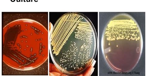 Merlins Micro World Staphylococcus Aureus Laboratory Diagnosis And