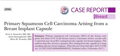 Squamous Cell Carcinoma Arising In Breast Implant Capsules