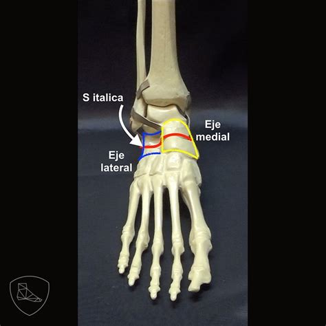 Todo Lo Que Necesitas Saber Sobre La Articulaci N De Chopart