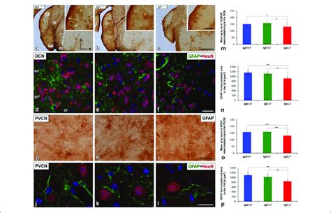 Gfap Immunostaining In The Dcn And Pvcn Of Igf1 −− Mice Gfap