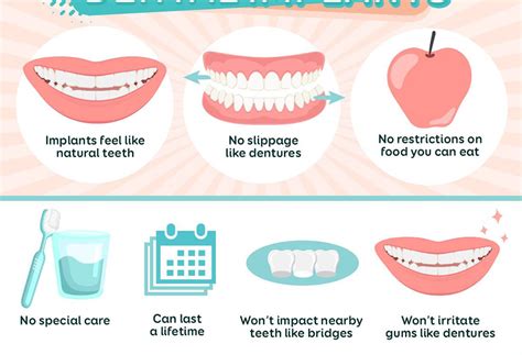 Top 13 Dental Implant Benefits You Should Be Aware Of