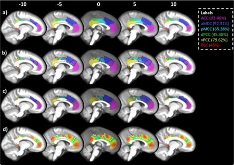 Clustering of the cingulate cortex. The cingulate cortex was... | Download Scientific Diagram