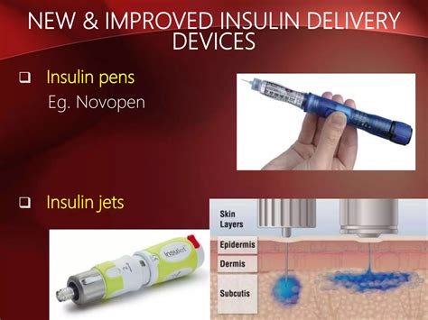 Recent advances in the treatment of diabetes mellitus | PPT