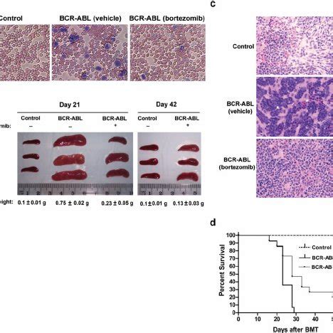 FoxO3a TRAIL And BIM Are Suppressed In A BCR ABL Induced CML Mouse