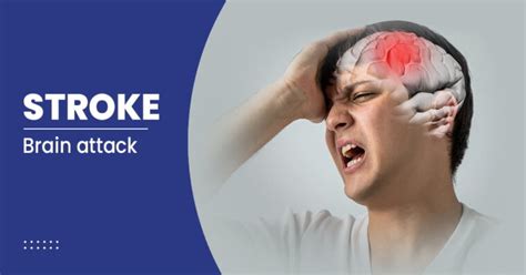 What Causes a Stroke? - FAQs