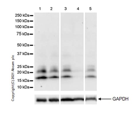 Anti Von Hippel Lindau VHL Antibody EPR24354 128 AB270968 Abcam