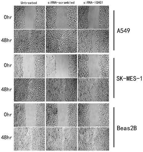 Igg Down Regulation Inhibits Cell Migration By Wound Healing Assay In