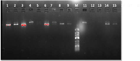 Agarose Gel Picture Showing Amplification Of 18s Rrna Gene Of Field