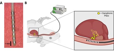 Optimization Of Transesophageal Atrial Pacing To Assess Atrial Fibrillation Susceptibility In