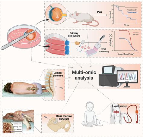 Frontiers Treatment Of Retinoblastoma What Is The Latest And What Is