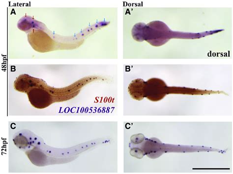 Expression Pattern Of Loc At Different Developmental Stages Of