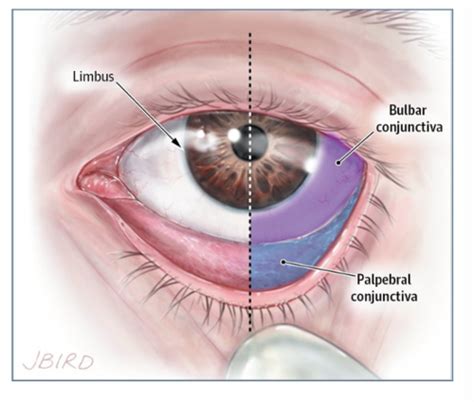 Ocular Adnexa Conjunctiva Flashcards Quizlet