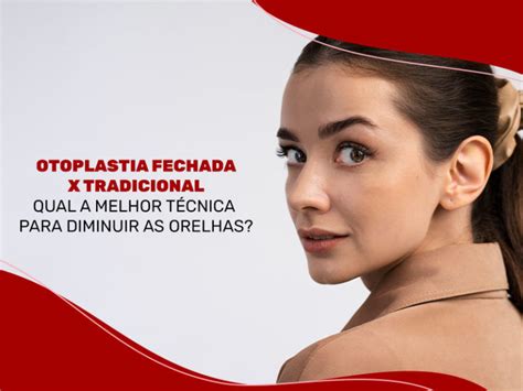 Otoplastia Como Feita A Cirurgia Na Orelha Dream Plastic