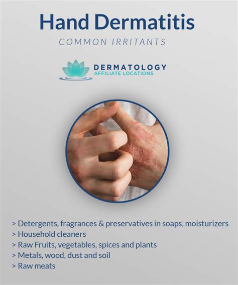 Hand Dermatitis: Everything You Should Know for Prevention & More