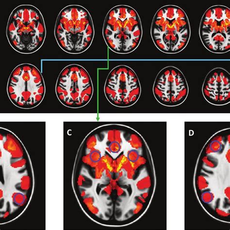 Normative Functional Connectivity Networks For DBS And Non Invasive