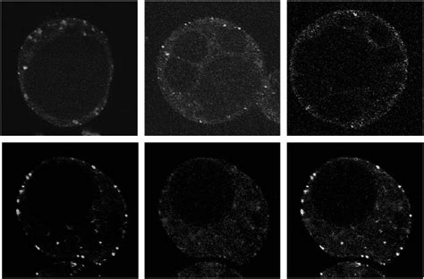 Cellular And Developmental Function Of Acap Type Arf Gap Proteins Are