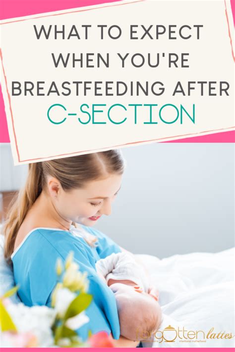 Breastfeeding After A C Section What You Need To Know Now Forgotten