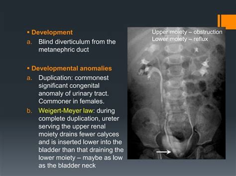 Kub - xray and usg | PPT