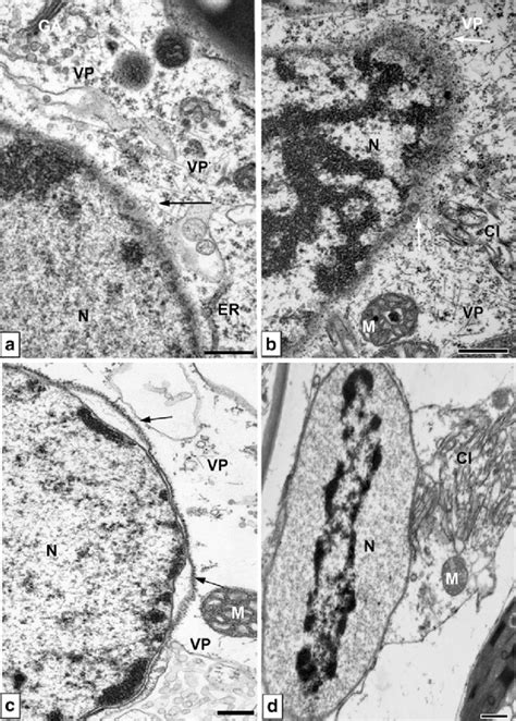 Ultrastructural Changes In Cell Nucleus During Pvy Ntn Or Pvy N Wi