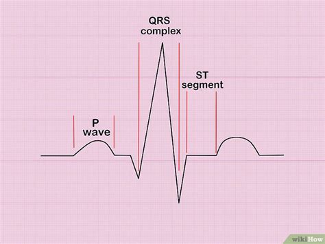 Cómo Calcular La Frecuencia Cardiaca A Partir De Un Ecg