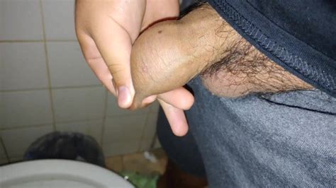 Using My Foreskin As A Piss Balloon Xxx Mobile Porno Videos And Movies Iporntvnet