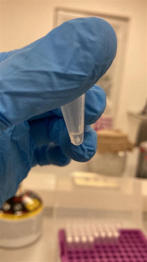 dna extraction  sterivex   polycarbonate filter  en