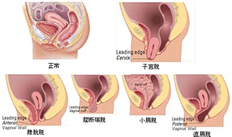 女性泌尿器科・ウロギネコロジーセンター 社会医療法人 東和会グループ 第一東和会病院