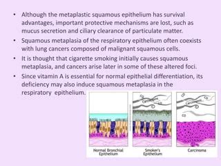 Metaplasia & Dysplasia | PPT