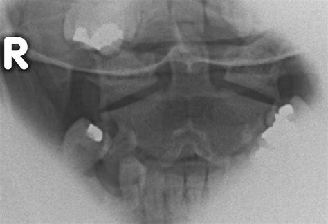 The Cervical Spine