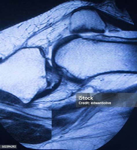 Mri Magnetic Resonansi Pencitraan Pemindaian Medis Foto Stok Unduh