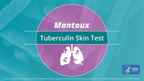 Mantoux Tuberculin Skin Test Video Youtube